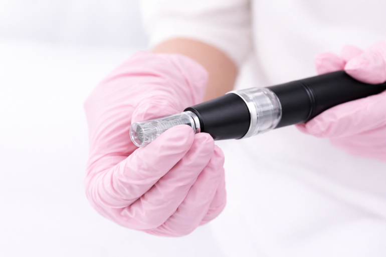 Mezoterapia mikroigłowa