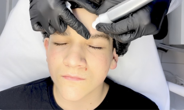 Aktualizacja lekcji – kobido, mezoterapia, oczyszczanie wodorowe, pinezkowanie, dermaplaning, face taping