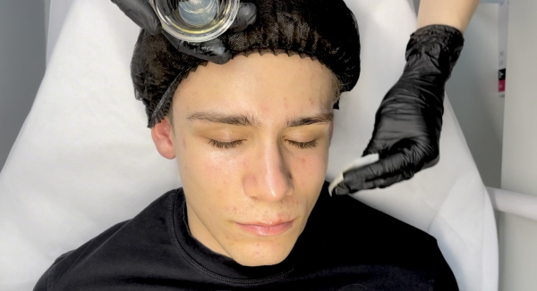 Chemical peels course – new materials and treatment protocols