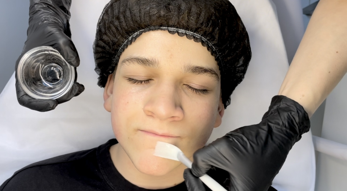 Facial acids – how they work and the differences between AHA, BHA, and PHA