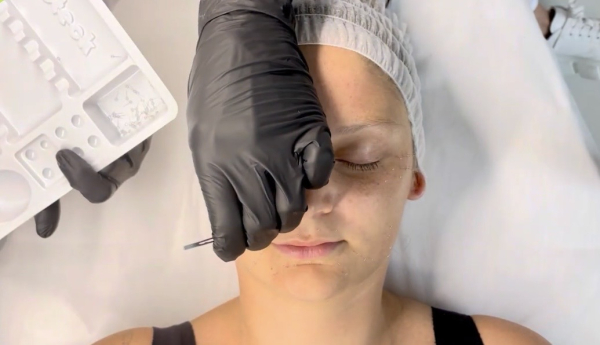 Facial Intradermal Therapy Course – Updated