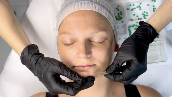 Facial Intradermal Therapy Course – Updated