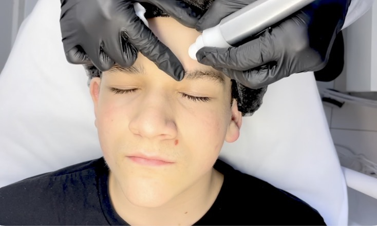 Hydrogen facial – skin benefits and results