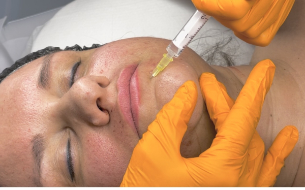 Injection mesotherapy – clinical protocols & safety standards