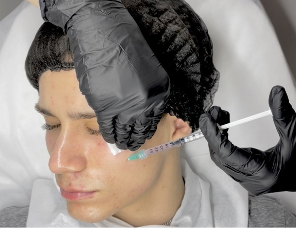 Kurs Mezoterapia igłowa - aktualizacja