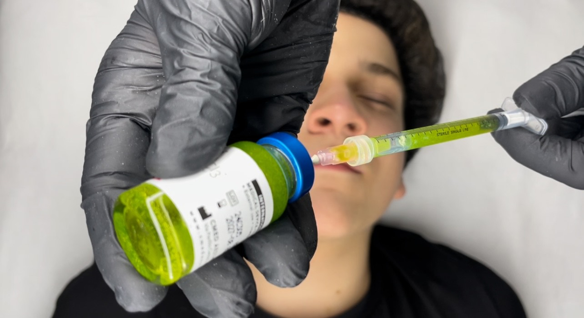 Kurs mezoterapii mikroigłowej – nowy moduł mezoterapii z BioRePeel na platformie Beauty Expert Online