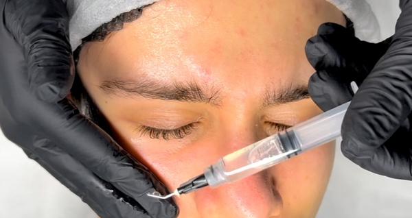 Nowa cena! Kurs PRX-T33 + mezoterapia mikroigłowa