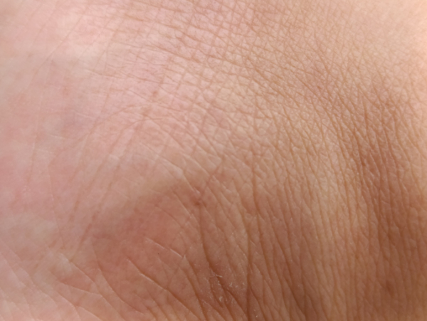 Skin aging online course – advanced skin rejuvenation and deep tissue therapies