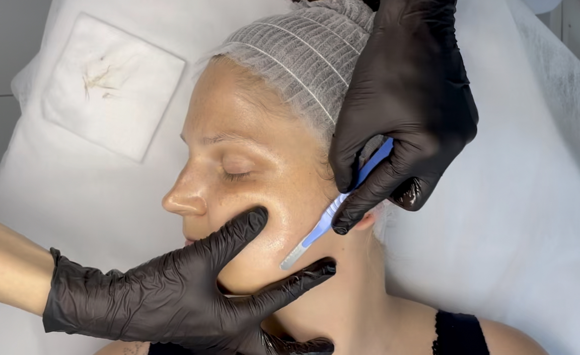 Step-by-step dermaplaning – facial exfoliation and skin smoothing technique taught during a treatment course.