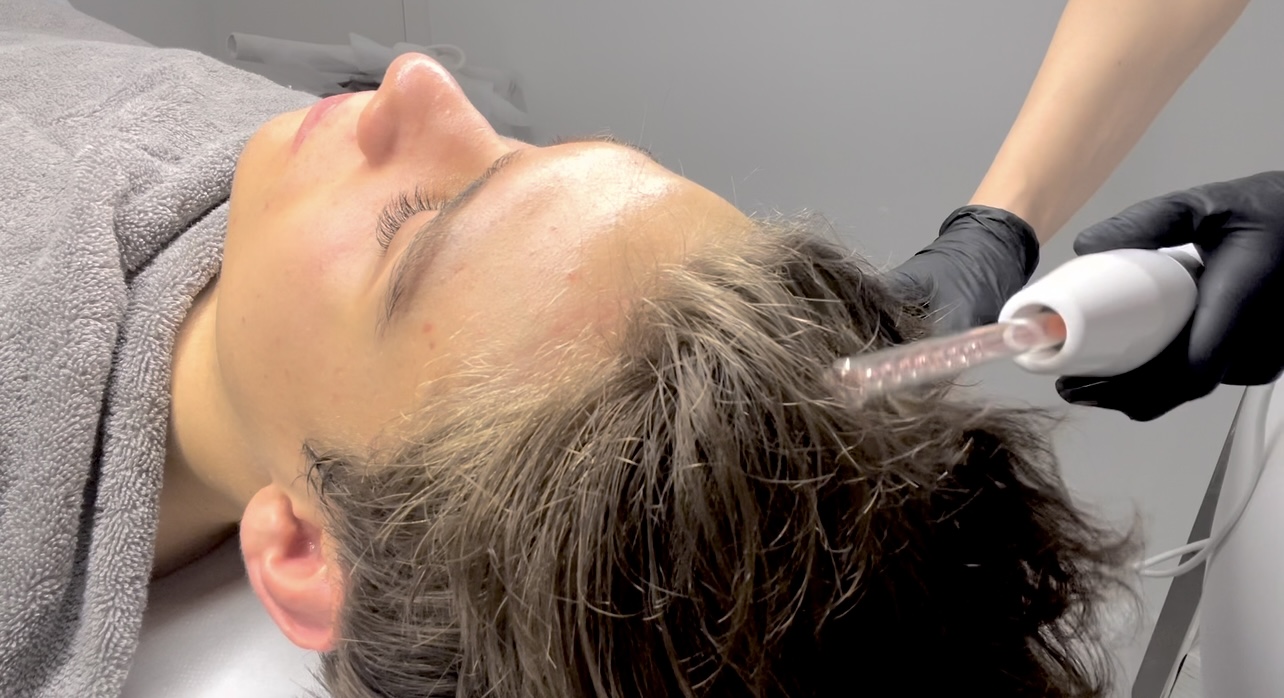 Trichology treatment on the scalp – product application during an online beauty school lesson.