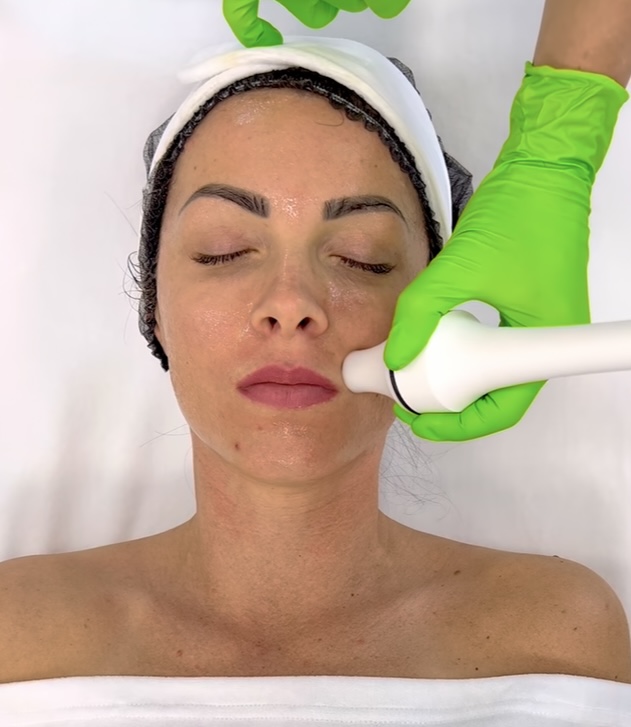 Radiofrequency (RF) training – skin tightening effects, collagen remodeling, and treatment procedure overview.