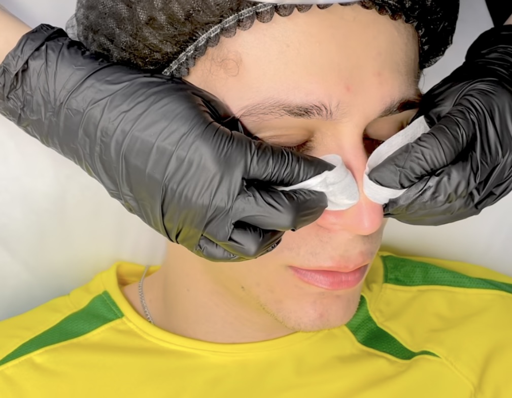 Manual extraction course – skin analysis, treatment steps, and theory behind deep pore cleansing.