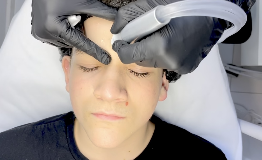 Hydrafacial course – hydrogen mechanism, electrolysis process, and free radical neutralization.
