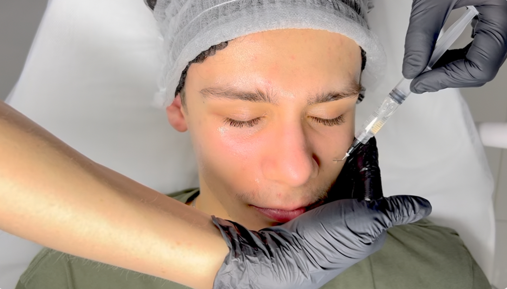 Szkolenie z peelingów chemicznych – mechanizm działania, rodzaje eksfoliacji i protokoły zabiegowe z PRX-T33 i BioRePeel.