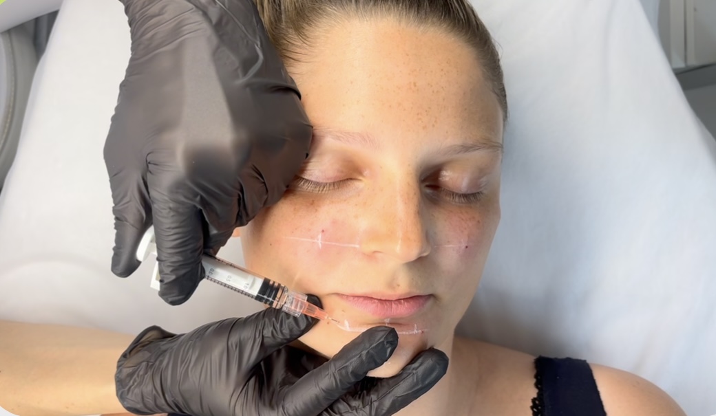 Polynucleotides course – restoring ECM, stimulating collagen, and improving hydration.