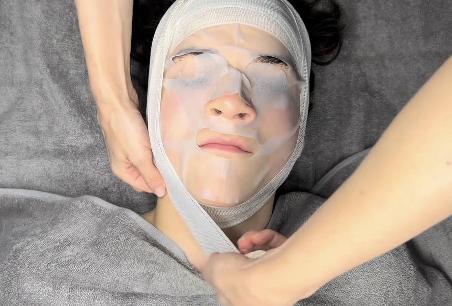 Facial Intradermal Needling procedure – precise technique stimulating fibroblasts and collagen regeneration for firmer, rejuvenated skin.