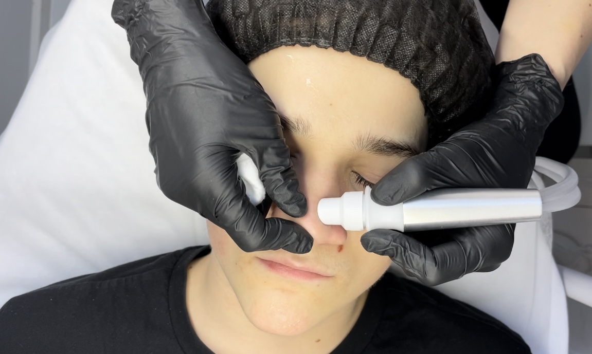 Practical part of the hydrafacial cleansing course – comprehensive skincare procedure using multiple treatment technologies.